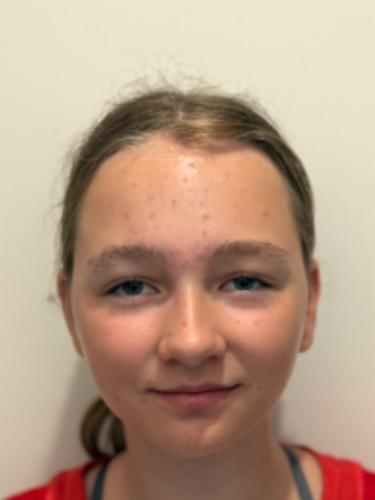 Johanna Bergner